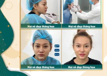 Thẩm Mỹ Anchee Clinic – Tiêm Môi Baby An Toàn, Phom Chuẩn