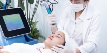 trị thâm bằng laser
