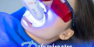 Tẩy trắng răng bằng công nghệ PLASMA NANO WHITE tại Nha Khoa Shark