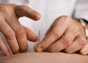 châm cứu tại nhà đà nẵng