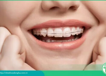 Nha khoa Đăng Lưu cung cấp dịch vụ niềng răng chất lượng