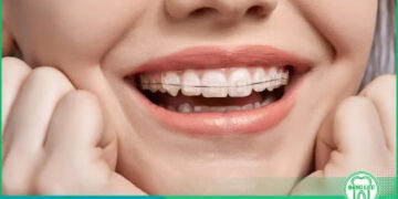 Nha khoa Đăng Lưu cung cấp dịch vụ niềng răng chất lượng