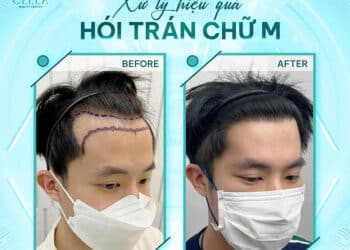 Viện Cấy Tóc Đà Nẵng Cella