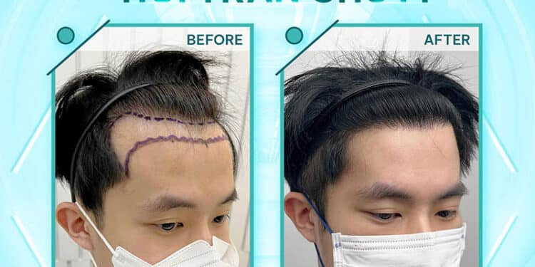 Viện Cấy Tóc Đà Nẵng Cella